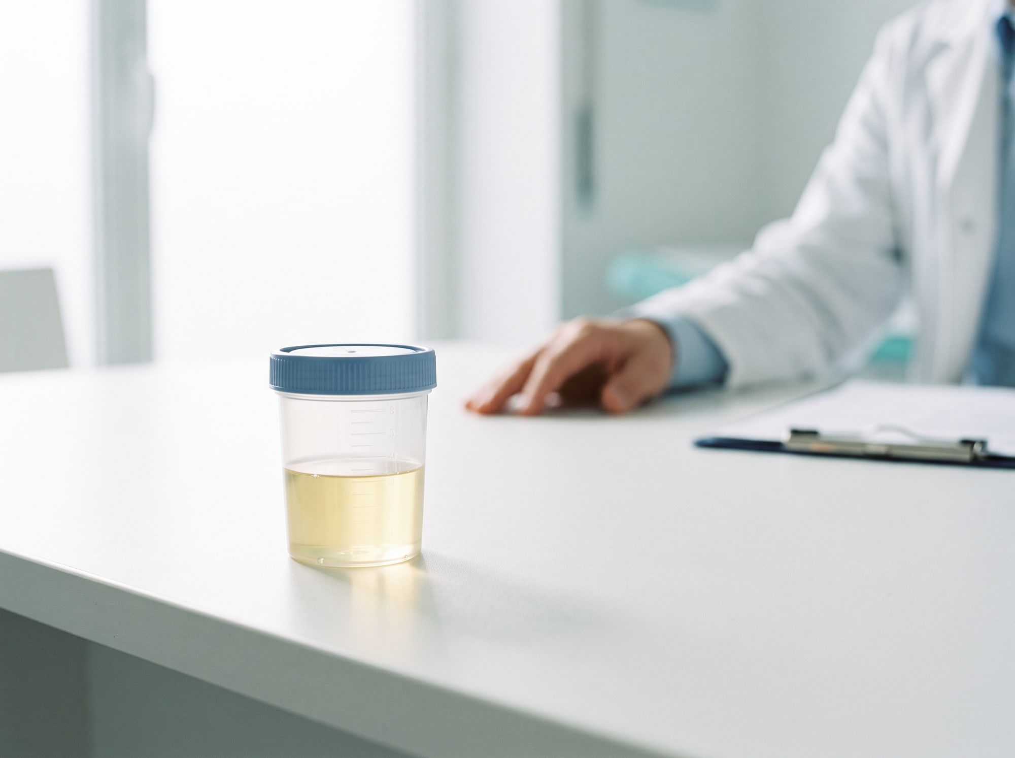 Contenitore sterile per l’esame delle urine
