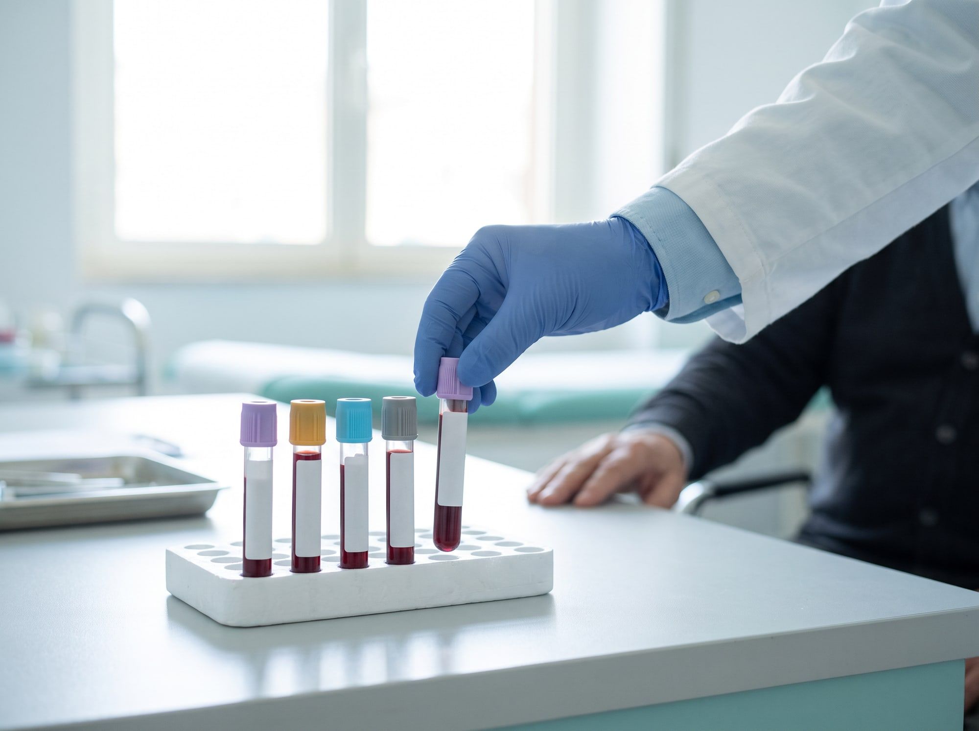 Provette per gli esami del sangue in un portaprovette